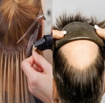 Hair Fixing Service in Kolkata