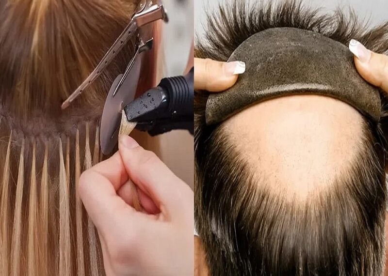 Hair Fixing Service in Kolkata