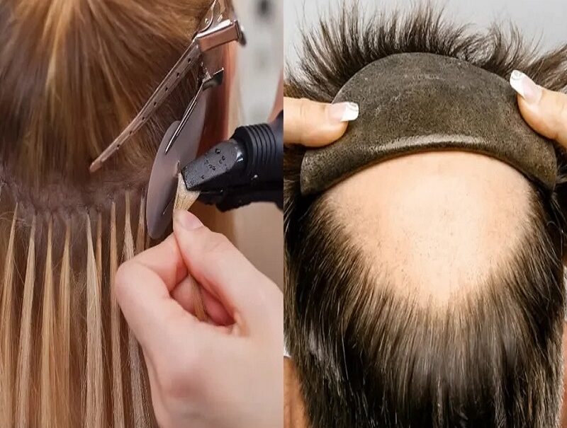Hair Fixing Service in Kolkata