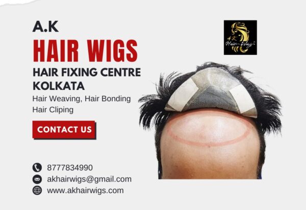 Hair Patch Fixing Services in Kolkata