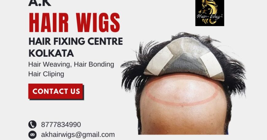 Hair Patch Fixing Services in Kolkata