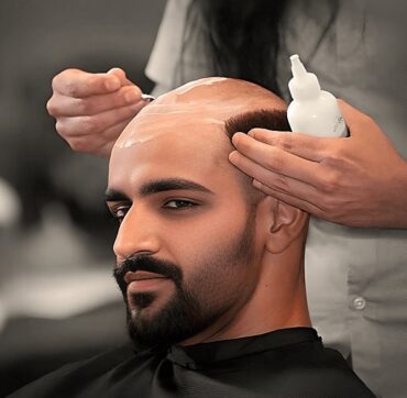 Non Surgical Hair Replacement Service Centre in Kolkata