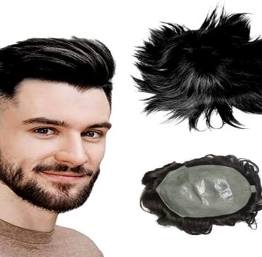 Hair Patch Service in Kolkata