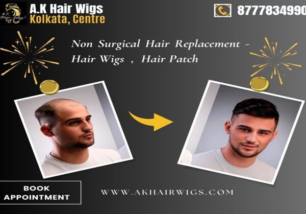 Best Non-Surgical Hair Replacement Centre in Kolkata