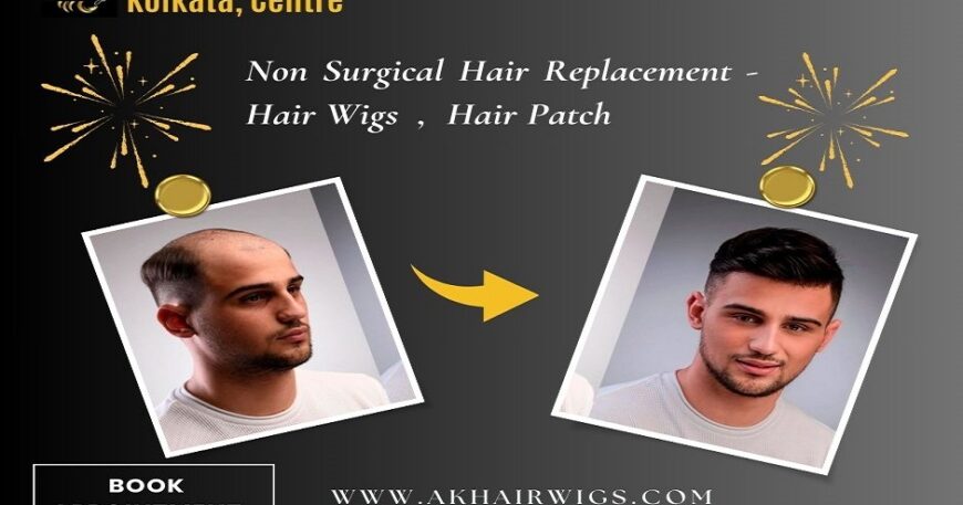 Best Non-Surgical Hair Replacement Centre in Kolkata