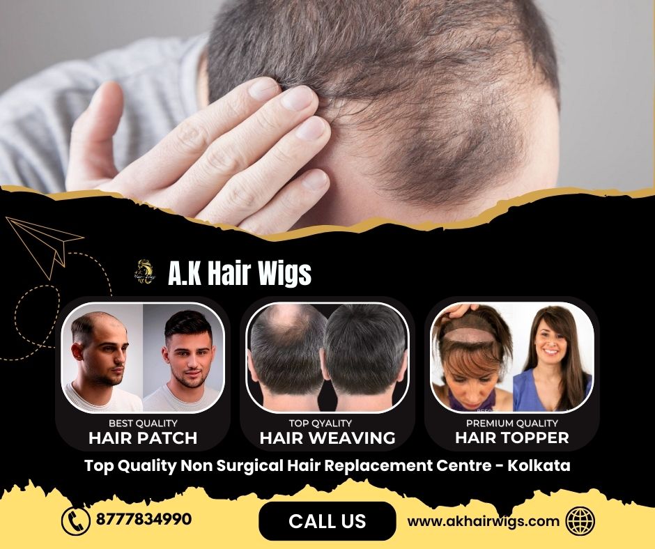 Non Surgical Hair Replacement in Kolkata