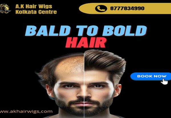 non surgical hair replacement in kolkata - A.K Hair Wigs ..