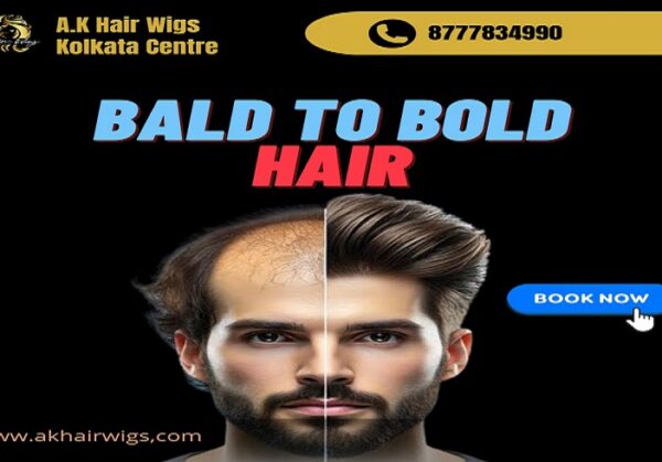 non surgical hair replacement in kolkata - A.K Hair Wigs ..