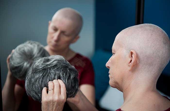 Chemotherapy Wigs in Kolkata