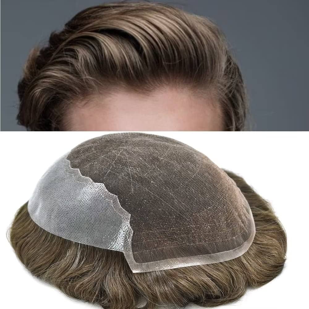 Hair Patch Fixing in Kolkata