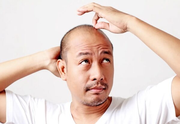 Non Surgical Hair Replacement Solution in Kolkata