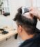 Hair Patch for Men in Kolkata at A.K Hair Wigs – Say Goodbye to Baldness!