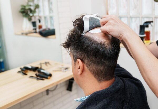 Hair Patch For men in kolkata -Goodbye to Baldness