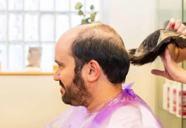 Hair patch in Kolkata | Caring Tips For Your Hair Patch in the Summer