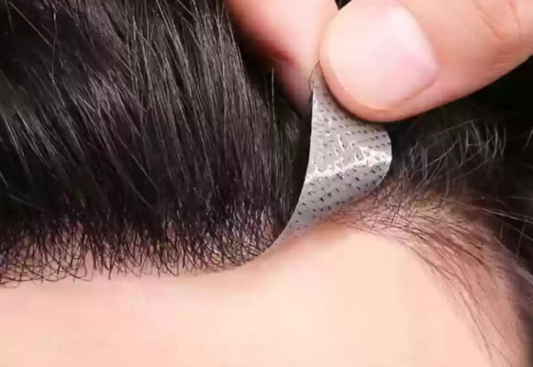 Premium Hair Patches in Kolkata