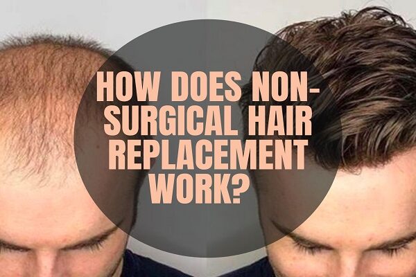 Hair Patch Kolkata Starting Price Rs.4999 For Men & Women At A.K Hair Wigs