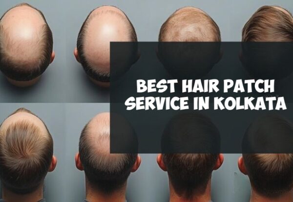Hair Patch Price in Kolkata At A.K Hair Wigs