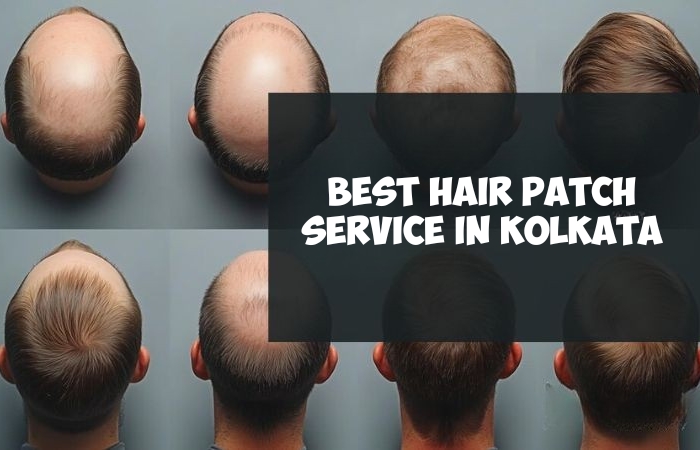 Hair Patch Price in Kolkata At A.K Hair Wigs