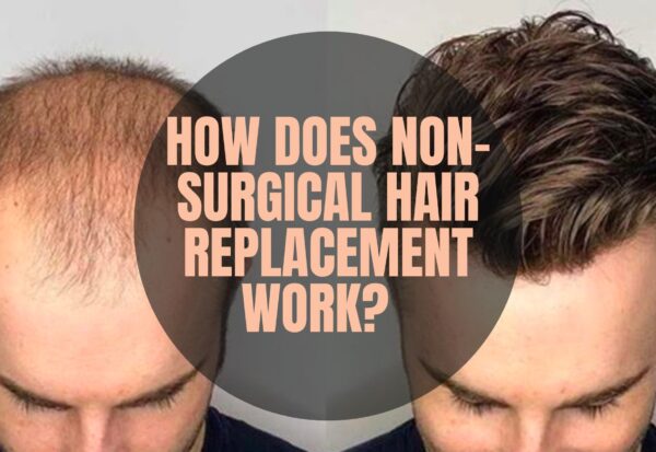 Hair Patch Starting Price Rs. 4999 in Kolkata At A.K Hair Wigs