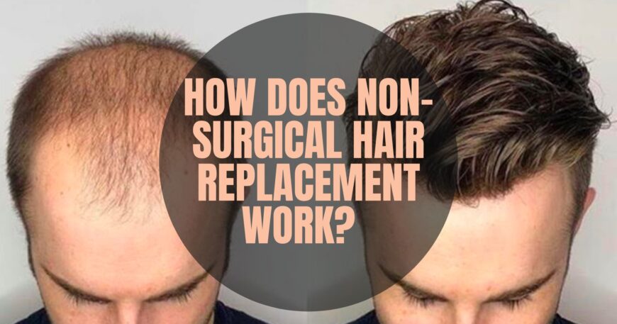 Hair Patch Starting Price Rs. 4999 in Kolkata At A.K Hair Wigs