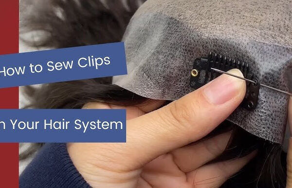 Hair Patch in Kolkata