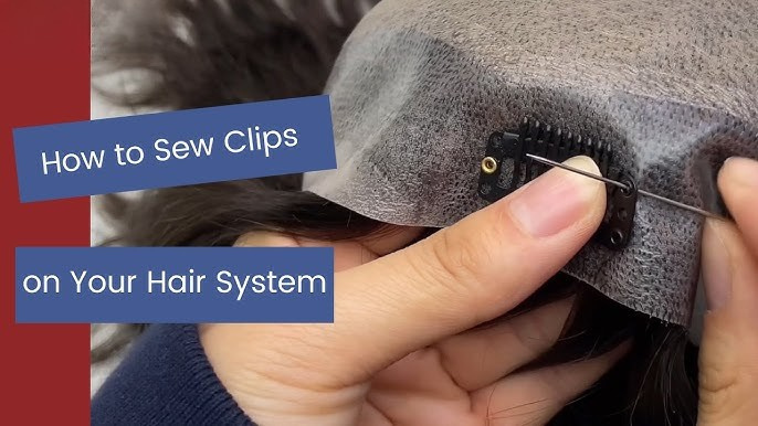 Hair Patch in Kolkata