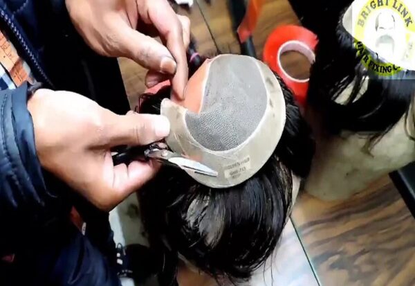 Affordable Hair Patch Services in Kolkata