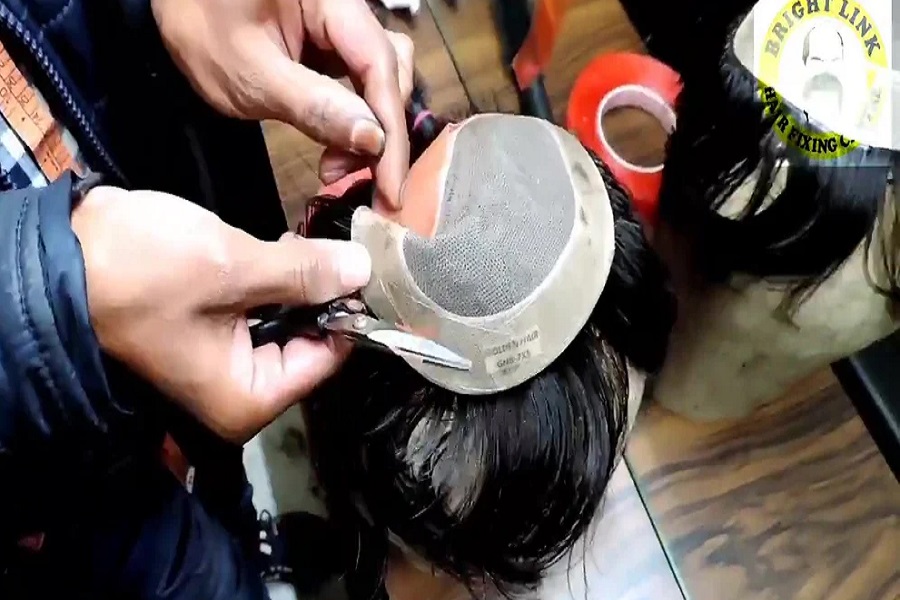 Affordable Hair Patch Services in Kolkata