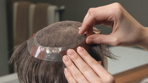 Best Hair Patch For Men Starting Rs. 5999 in Kolkata