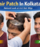 Hair Patch in Kolkata – Natural & Non-Surgical Hair Replacement